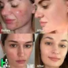 سرم پیلینگ سوکسینیک اسید لایه‌بردار و ضدجوش قوی مدی کیوب  Medicube Red Succinic Acid Peel - تصویر 4