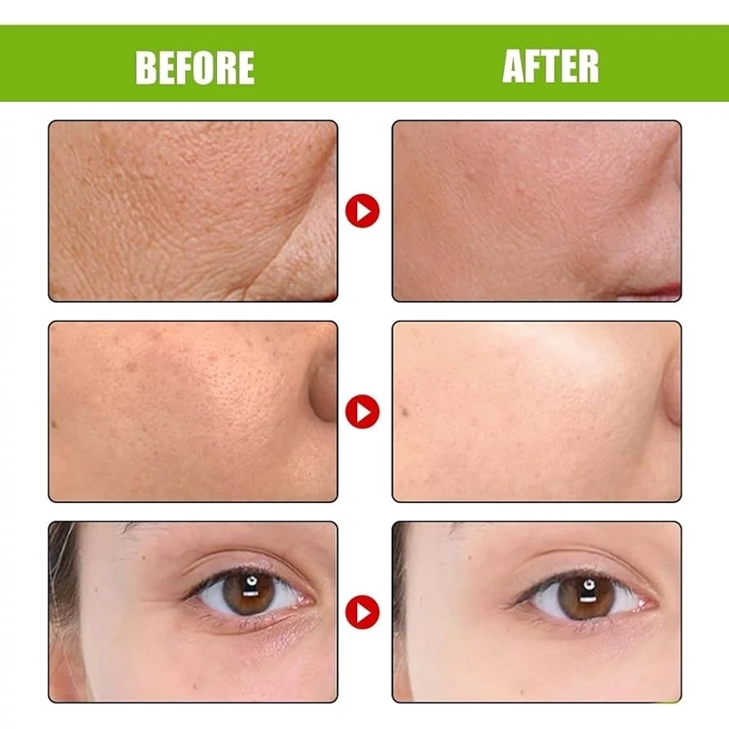 کرم بوستر سفتکننده و ضدچروک و جوانساز پوست سلیمکس SlimMax Firming & Anti-Wrinkle Booster Cream 19 کرم بوستر سفتکننده و ضدچروک سلیمکس SlimMax